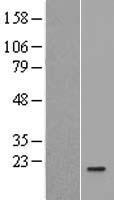 IL36RN / IL1F5 Protein - Western validation with an anti-DDK antibody * L: Control HEK293 lysate R: Over-expression lysate