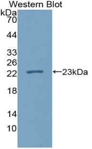 IL37 Antibody - Western blot of recombinant IL37.