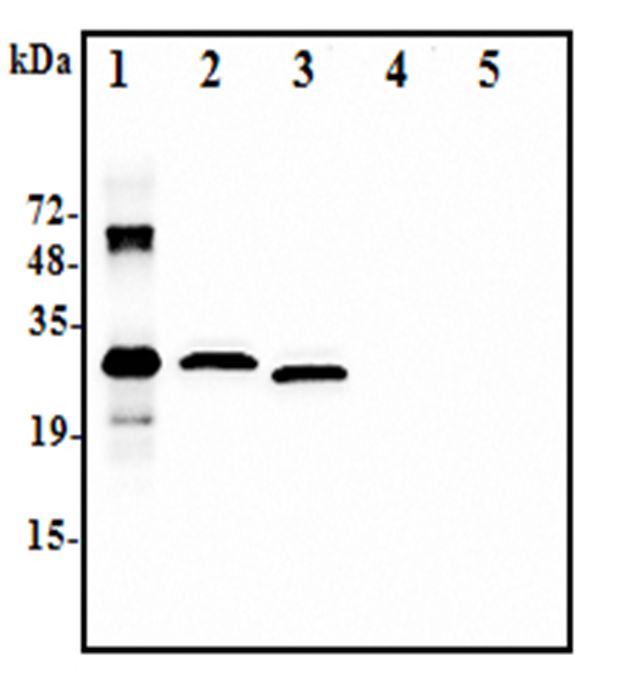 IL37 Antibody - Western blot analysis using anti-IL-37 (human), pAb at 1:2.000 dilution:.1. Recombinant human IL-37-His (50ng).2. Human IL-37-FLAG transfected HEK293 cell lysate(100microg).3. Human IL-37-tag free transfected HEK293 cell lysate(100microg).4. Empty vector transfected HEK293 cell lysate(100microg).5. A unrelated protein-His (50ng)