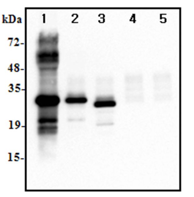 IL37 Antibody - Immunoprecipitation of human IL-37 using anti-IL-37 at 1:500 dilutions:.1. Recombinant human IL-37-His (1microg).2. Human IL-37-FLAG transfected HEK293 cell lysate(500microg).3. Human IL-37-tag free transfected HEK293 cell lysate(500microg).4. Empty vector transfected HEK293 cell lysate(500microg).5. A unrelated protein-His (1microg)