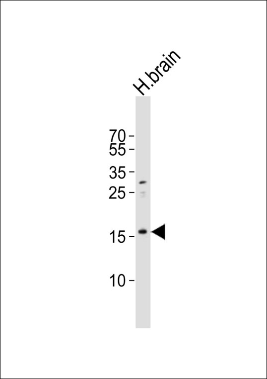 IL37 Antibody - Western blot of lysate from human brain tissue lysate, using IL37 Antibody (A1-1822). A1-1822 was diluted at 1:500. A goat anti-rabbit IgG H&L (HRP) at 1:10000 dilution was used as the secondary antibody.Lysate at 20 ug.