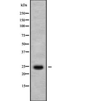 IL37 Antibody - Western blot analysis IL1F7 using HepG2 whole cells lysates