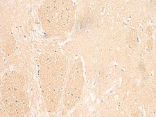 IL37 Antibody - Immunohistochemistry of paraffin-embedded Human brain tissue  using IL37 Polyclonal Antibody at dilution of 1:50(×200)