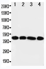 IL3RA / CD123 Antibody - WB of IL3RA / CD123 antibody. All lanes: Anti-IL3RA at 0.5ug/ml. Lane 1: A431 Whole Cell Lysate at 40ug. Lane 2: SMMC Whole Cell Lysate at 40ug. Lane 3: U87 Whole Cell Lysate at 40ug. Lane 4: 293T Whole Cell Lysate at 40ug. Predicted bind size: 43KD. Observed bind size: 43KD.