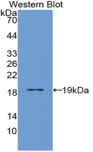 IL3RA / CD123 Antibody - Western blot of recombinant IL3RA / CD123.  This image was taken for the unconjugated form of this product. Other forms have not been tested.