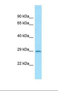 IL3RA / CD123 Antibody - Western blot of Human THP-1 . IL3RA antibody dilution 1.0 ug/ml.  This image was taken for the unconjugated form of this product. Other forms have not been tested.