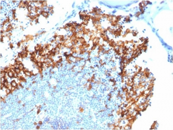 IL3RA / CD123 Antibody - IHC staining of FFPE human lymph node with CD123 antibody. HIER: boil tissue sections in 10mM Tris with 1mM EDTA, pH 9 for 10-20 min and allow to cool.