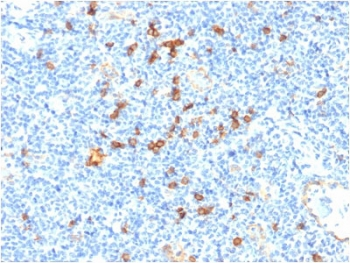 IL3RA / CD123 Antibody - IHC staining of FFPE human tonsil with CD123 antibody. HIER: boil tissue sections in 10mM Tris with 1mM EDTA, pH 9 for 10-20 min and allow to cool.