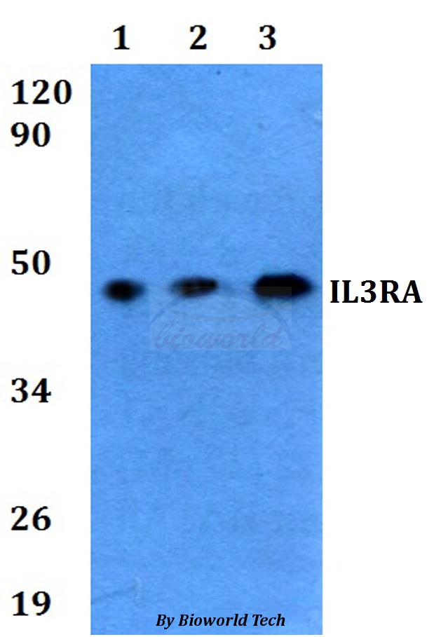 IL3RA / CD123 Antibody - Western blot of IL3RA antibody at 1:500 dilution. Lane 1: MCF-7 whole cell lysate. Lane 2: NIH-3T3 whole cell lysate. Lane 3: PC12 whole cell lysate.
