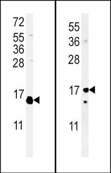 IL4 Antibody - (LEFT)Western blot of IL4 Antibody in WiDr cell line lysates (35 ug/lane). IL4 (arrow) was detected using the purified antibody.(RIGHT)Western blot of IL4 Antibody in mouse cerebellum cell line lysates (35 ug/lane). IL4(arrow) was detected using the purified antibody.