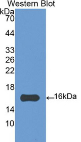 IL4 Antibody - Western blot of IL4 antibody.