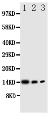 IL4 Antibody - Anti-IL-4 antibody, Western blotting All lanes: Anti IL-4 at 0.5ug/ml Lane 1: Recombinant Human IL-4 Protein 10ng Lane 2: Recombinant Human IL-4 Protein 5ng Lane 3: Recombinant Human IL-4 Protein 2. 5ng Predicted bind size: 14KD Observed bind size: 14KD