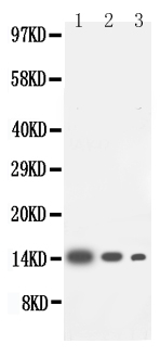 IL4 Antibody - Anti-IL-4 antibody, Western blotting Lane 1: Recombinant Human IL-4 Protein 10ng Lane 2: Recombinant Human IL-4 Protein 5ng Lane 3: Recombinant Human IL-4 Protein 2. 5ng