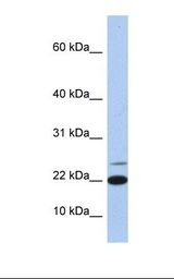 IL4 Antibody - Hela cell lysate. Antibody concentration: 1.0 ug/ml. Gel concentration: 10-20%.  This image was taken for the unconjugated form of this product. Other forms have not been tested.