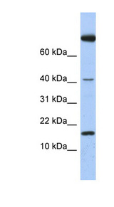IL4 Antibody - IL4 / IL-4 antibody Western blot of Fetal Spleen lysate. This image was taken for the unconjugated form of this product. Other forms have not been tested.