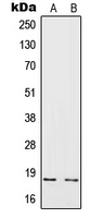IL4 Antibody - Western blot analysis of IL-4 expression in HeLa (A); Raji (B) whole cell lysates.