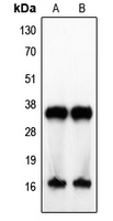 IL4 Antibody - Western blot analysis of IL-4 expression in Jurkat (A); human tonsil (B) whole cell lysates.
