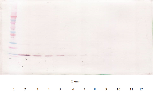 IL4 Antibody - Anti-Human IL-4 Western Blot Reduced