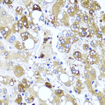 IL4 Antibody - Immunohistochemistry of paraffin-embedded human liver injury tissue.