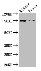 IL4 Antibody - Positive WB detected in:Mouse kidney tissue,Mouse brain tissue;All lanes: IL4 antibody at 3ug/ml;Secondary;Goat polyclonal to rabbit IgG at 1/50000 dilution;Predicted band size: 18,16 kDa;Observed band size: 90 kDa;