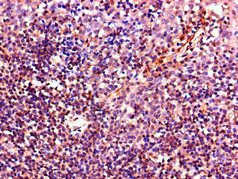 IL4 Antibody - Immunohistochemistry of paraffin-embedded human tonsil tissue using IL4 Antibody at dilution of 1:100