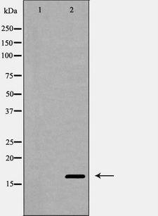 IL4 Antibody - Western blot analysis of Interleukin 4 expression in MCF-7 cells. The lane on the left is treated with the antigen-specific peptide.