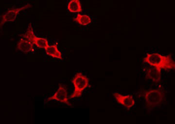 IL4 Antibody - Staining HeLa cells by IF/ICC. The samples were fixed with PFA and permeabilized in 0.1% Triton X-100, then blocked in 10% serum for 45 min at 25°C. The primary antibody was diluted at 1:200 and incubated with the sample for 1 hour at 37°C. An Alexa Fluor 594 conjugated goat anti-rabbit IgG (H+L) Ab, diluted at 1/600, was used as the secondary antibody.