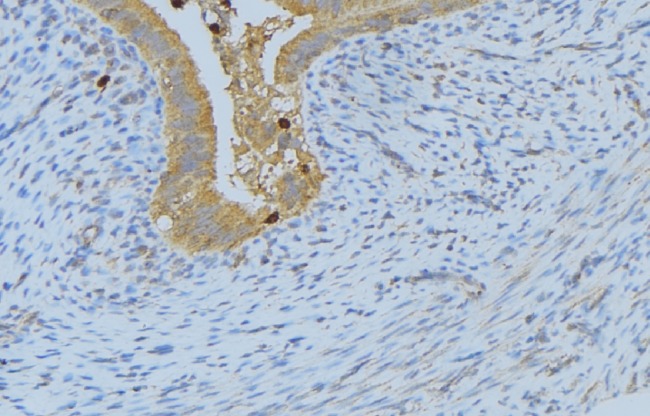 IL4 Antibody - 1:100 staining human uterus tissue by IHC-P. The sample was formaldehyde fixed and a heat mediated antigen retrieval step in citrate buffer was performed. The sample was then blocked and incubated with the antibody for 1.5 hours at 22°C. An HRP conjugated goat anti-rabbit antibody was used as the secondary.