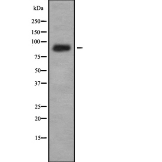 IL4R / CD124 Antibody - Western blot analysis IL-4R alpha using K562 whole cells lysates