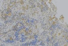 IL4R / CD124 Antibody - 1:100 staining human lymph node tissue by IHC-P. The sample was formaldehyde fixed and a heat mediated antigen retrieval step in citrate buffer was performed. The sample was then blocked and incubated with the antibody for 1.5 hours at 22°C. An HRP conjugated goat anti-rabbit antibody was used as the secondary.