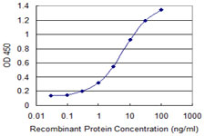 IL4R / CD124 Antibody - Detection limit for recombinant GST tagged IL4R is 0.1 ng/ml as a capture antibody.