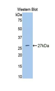 IL4R / CD124 Antibody - Western blot of recombinant IL4R / CD124.  This image was taken for the unconjugated form of this product. Other forms have not been tested.