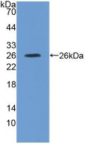 IL4R / CD124 Antibody - Western Blot; Sample: Recombinant IL4R, Rat.