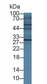IL4R / CD124 Antibody - Western Blot; Sample: Mouse Small intestine lysate; Primary Ab: 1µg/ml Rabbit Anti-Mouse IL4R Antibody Second Ab: 0.2µg/mL HRP-Linked Caprine Anti-Rabbit IgG Polyclonal Antibody