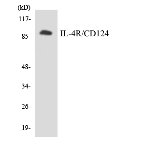 IL4R / CD124 Antibody - Western blot analysis of the lysates from HUVECcells using IL-4R/CD124 antibody.