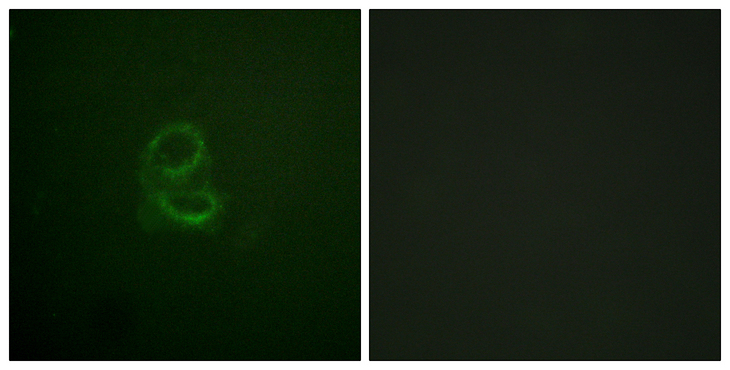 IL4R / CD124 Antibody - Immunofluorescence analysis of A549 cells, using IL-4R/CD124 Antibody. The picture on the right is blocked with the synthesized peptide.