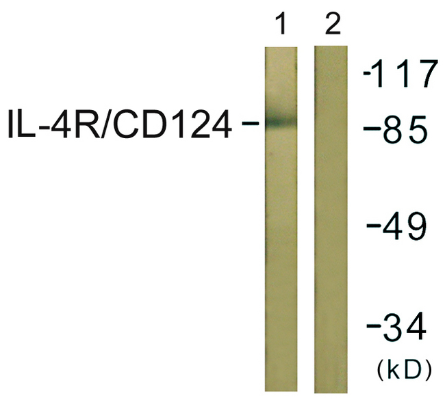 IL4R / CD124 Antibody - Western blot analysis of lysates from 293 cells, using IL-4R/CD124 Antibody. The lane on the right is blocked with the synthesized peptide.