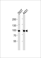 IL4R / CD124 Antibody - Western blot of lysates from 293T, A431 cell line (from left to right) with IL4R Antibody. Antibody was diluted at 1:1000 at each lane. A goat anti-rabbit IgG H&L (HRP) at 1:5000 dilution was used as the secondary antibody. Lysates at 35 ug per lane.