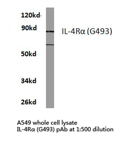 IL4R / CD124 Antibody - Western blot of IL-4R (G493) pAb in extracts from A549 cells.