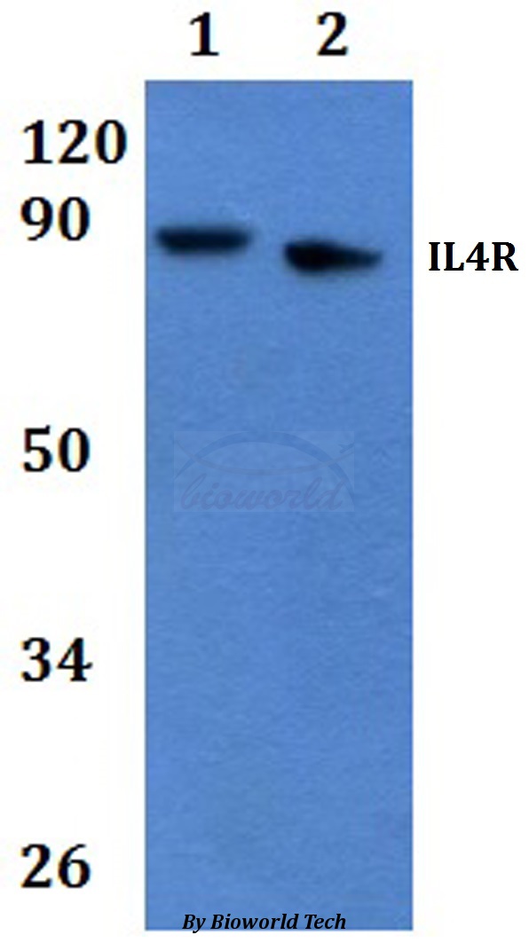 IL4R / CD124 Antibody - Western blot of IL4R antibody at 1:500 dilution. Lane 1: HEK293T whole cell lysate. Lane 2: RAW264.7 whole cell lysate.