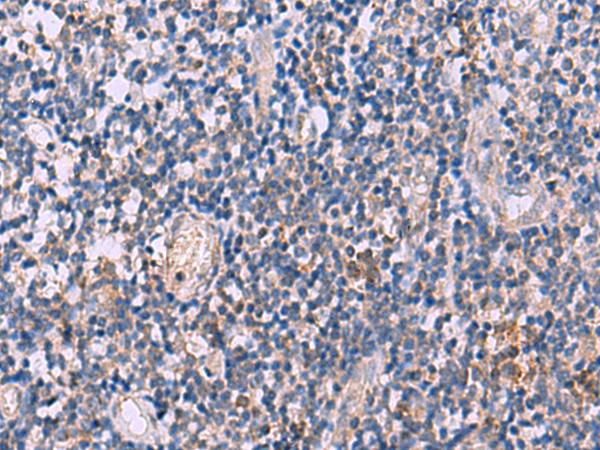 IL4R / CD124 Antibody - Immunohistochemistry of paraffin-embedded Human tonsil tissue  using IL4R Polyclonal Antibody at dilution of 1:45(×200)
