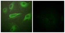 IL4R / CD124 Antibody - Immunofluorescence analysis of HeLa cells, using IL-4R/CD124 (Phospho-Tyr497) Antibody. The picture on the right is blocked with the phospho peptide.