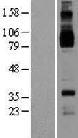 IL4R / CD124 Protein - Western validation with an anti-DDK antibody * L: Control HEK293 lysate R: Over-expression lysate