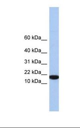 IL5 Antibody - Hela cell lysate. Antibody concentration: 1.0 ug/ml. Gel concentration: 10-20%.  This image was taken for the unconjugated form of this product. Other forms have not been tested.