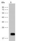 IL5 Antibody - Anti-IL5 rabbit monoclonal antibody at 1:500 dilution. Lane A: Hela Whole Cell Lysate. Lysates/proteins at 30 ug per lane. Secondary: Goat Anti-Rabbit IgG (H+L)/HRP at 1/10000 dilution. Developed using the ECL technique. Performed under reducing conditions. Predicted band size: 15 kDa. Observed band size: 20 kDa.