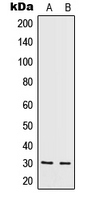 IL5 Antibody - Western blot analysis of IL-5 expression in HeLa (A); HepG2 (B) whole cell lysates.