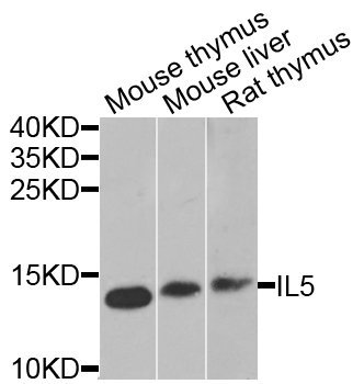 IL5 Antibody - Western blot analysis of extracts of various cell lines.