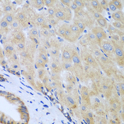 IL5 Antibody - Immunohistochemistry of paraffin-embedded human liver tissue.