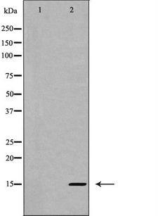 IL5 Antibody - Western blot analysis of Interleukin 5 expression in HT29 cells. The lane on the left is treated with the antigen-specific peptide.