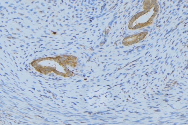 IL5 Antibody - 1:100 staining human uterus tissue by IHC-P. The sample was formaldehyde fixed and a heat mediated antigen retrieval step in citrate buffer was performed. The sample was then blocked and incubated with the antibody for 1.5 hours at 22°C. An HRP conjugated goat anti-rabbit antibody was used as the secondary.